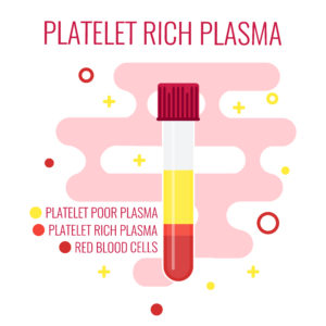 platelet-rich-plasma