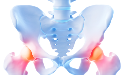 3 Common Hip Injuries – and How to Treat Them